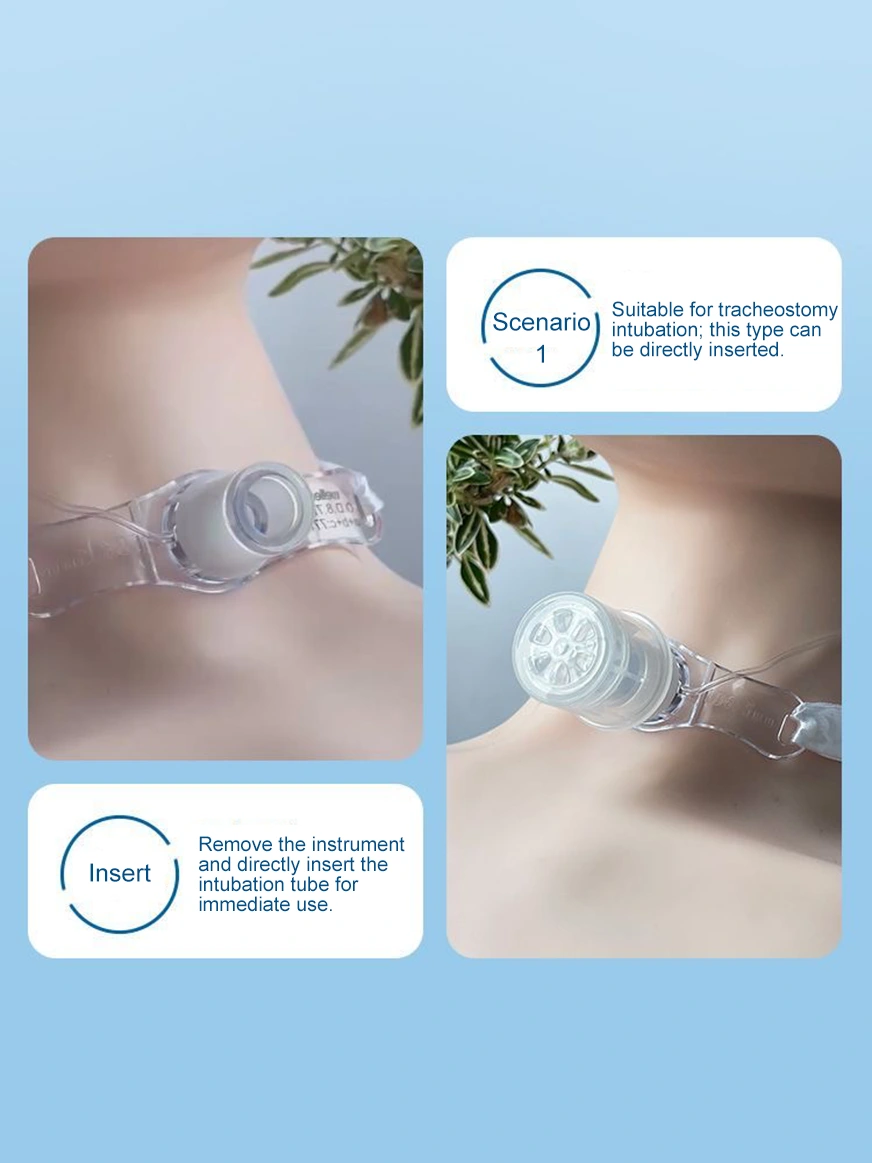 Tracheostomy Speaking Valve